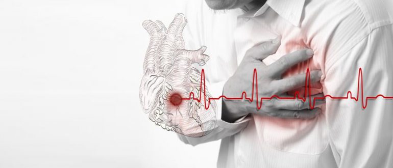 инфаркт миокарда и гипертоническая болезнь